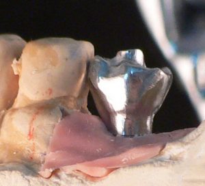 milling framework cad cam 3d dental
