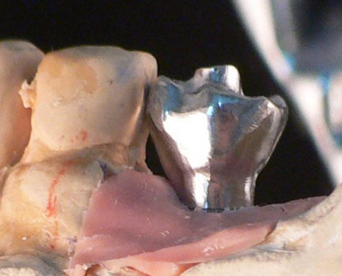 milling framework cad cam 3d dental